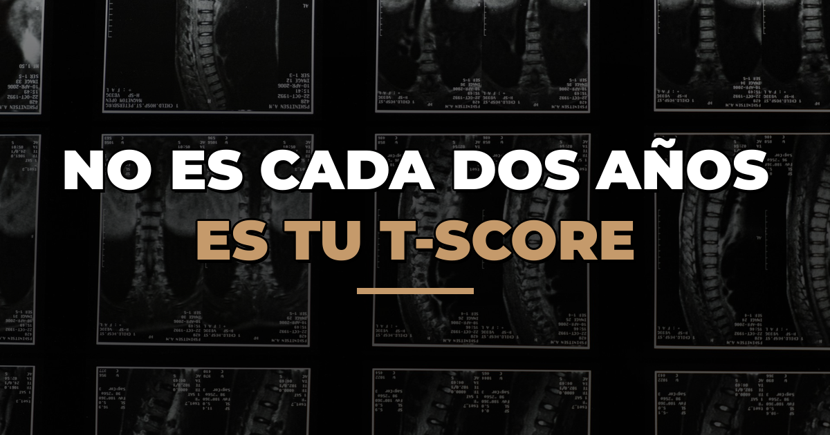 Cada cuánto hacerse una densitometría: la respuesta depende de tu T-score