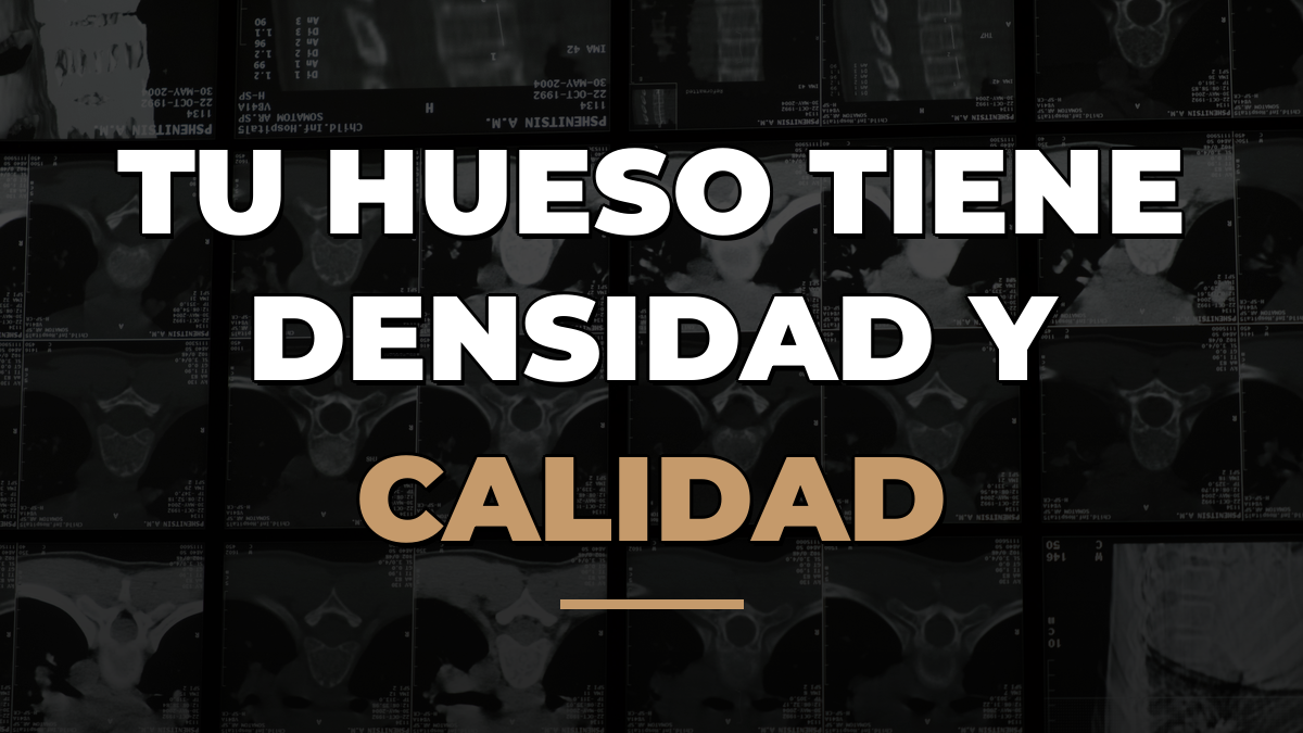 TBS (Trabecular Bone Score): la calidad de tu hueso que tu densitometría no te está contando